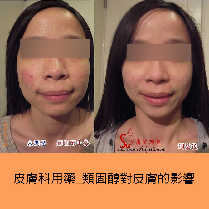 [保養日記] 什麼是膚質調整？