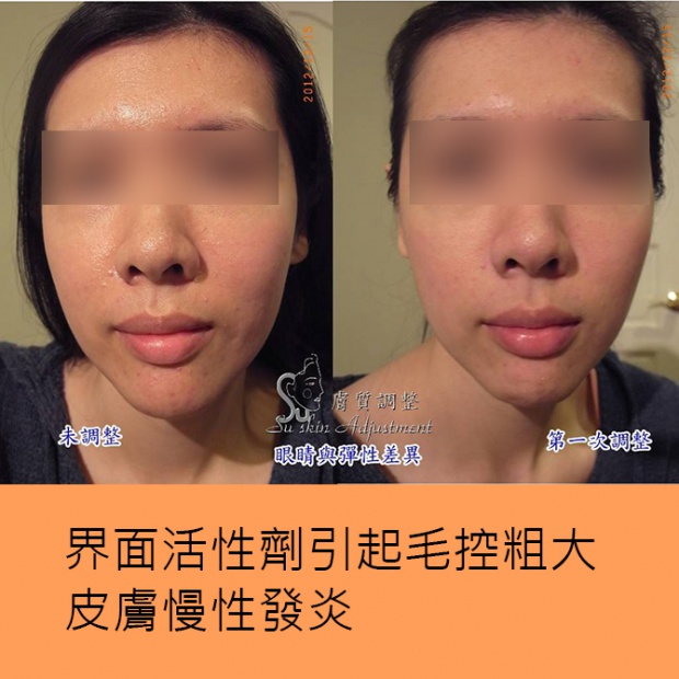 膚質調整與醫美、皮膚科、保養品的差異