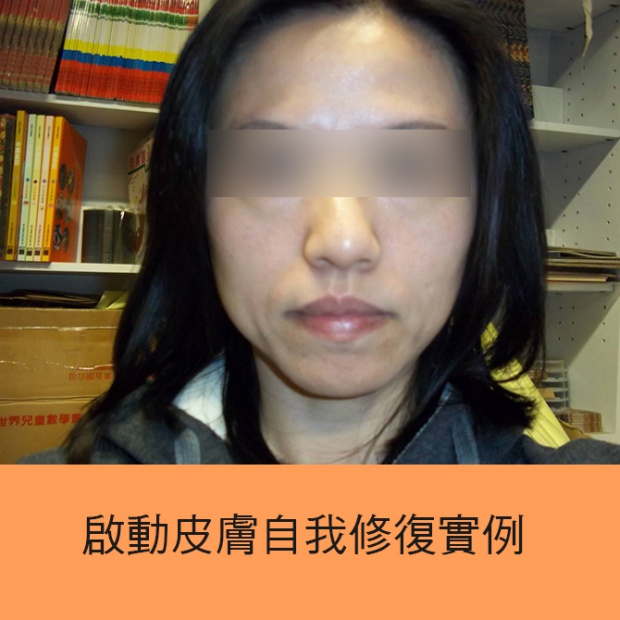 膚質調整4大階段